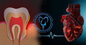ایمپلنت دندان در بیماران قلبی