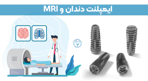 آیا ایمپلنت دندان با MRI تداخل داره؟ آیا ایمپلنت دندان با MRI تداخل داره؟