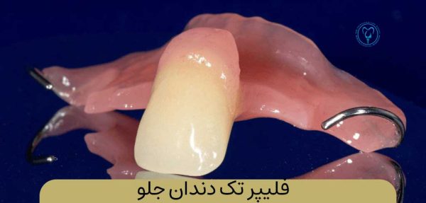 فلیپر دندان چیست
