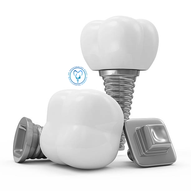 بهترین مرکز ایمپلنت غرب تهران جنت آباد