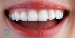 طراحی لبخند دیجیتال