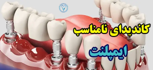 موارد منع کاشت ایمپلنت دندان