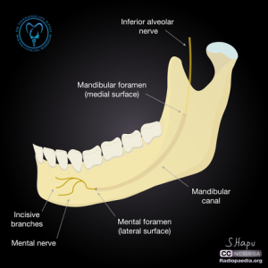 کانال مندیبولار و ایمپلنت