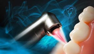 ایمپلنت دندان با لیزر