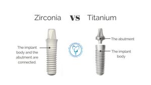 ایمپلنت تیتانیومی و زیرکونیومی