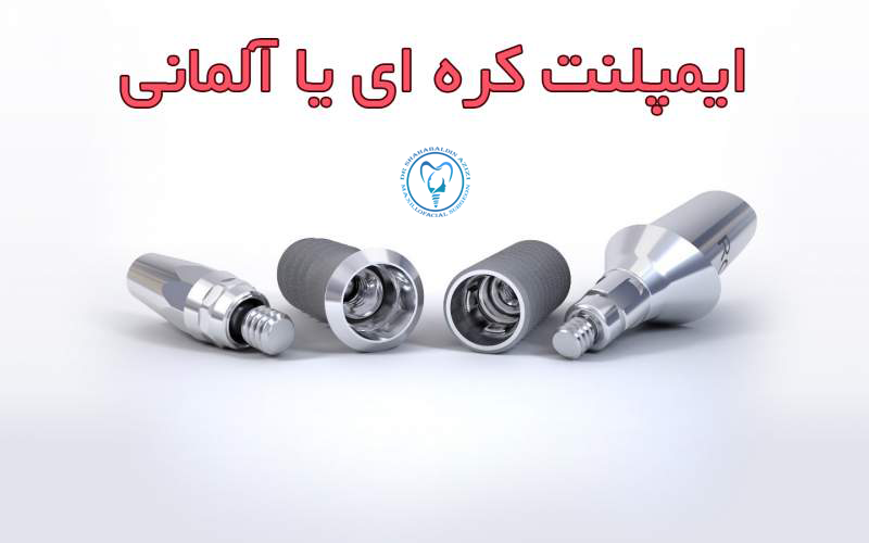 ایمپلنت کره ای بهتر است یا آلمانی؟