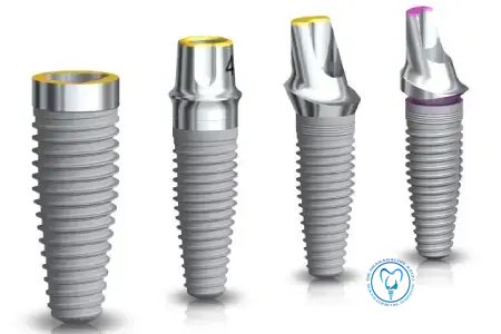 بهترین فیکسچر ایمپلنت