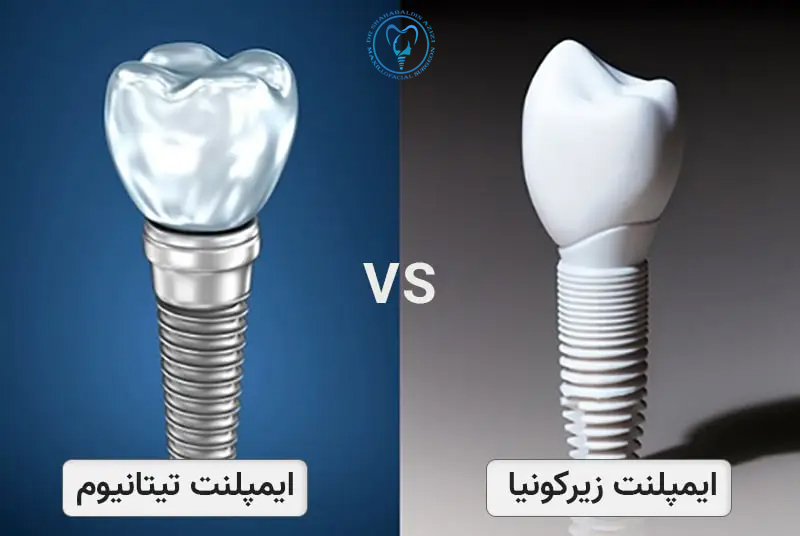 تفاوت ایمپلنت‌های تیتانیومی و زیرکونیومی