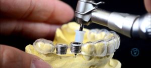 Surgical Guide ایمپلنت