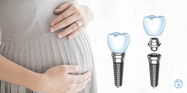 ایمپلنت و بارداری