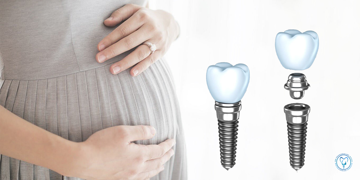 ایمپلنت و بارداری