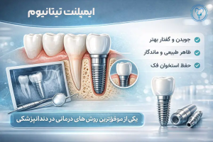 ایمپلنت دندان تیتانیومی