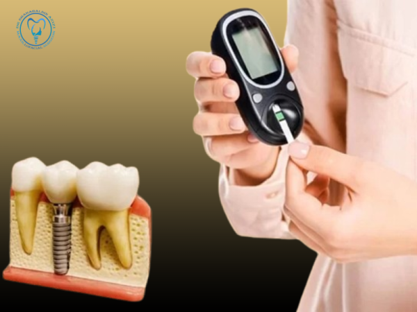 آیا افراد دیابتی می توانند ایمپلنت کنند آیا افراد دیابتی می توانند ایمپلنت کنند