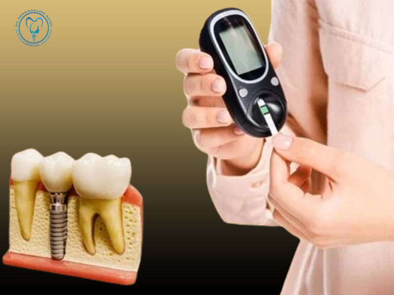 آیا افراد دیابتی می توانند ایمپلنت کنند