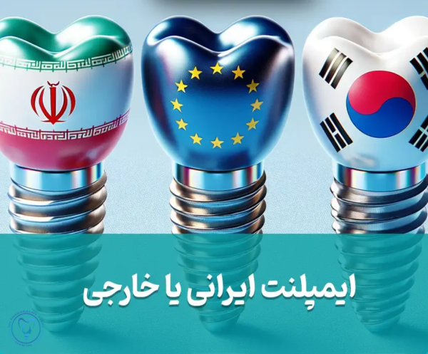 تفاوت ایمپلنت ایرانی و خارجی