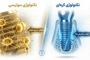 مقایسه ایمپلنت کره ای و سوئیسی