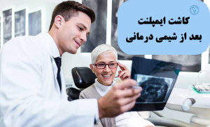 کاشت ایمپلنت بعد از شیمی درمانی