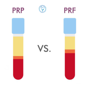 تفاوت prf و prp